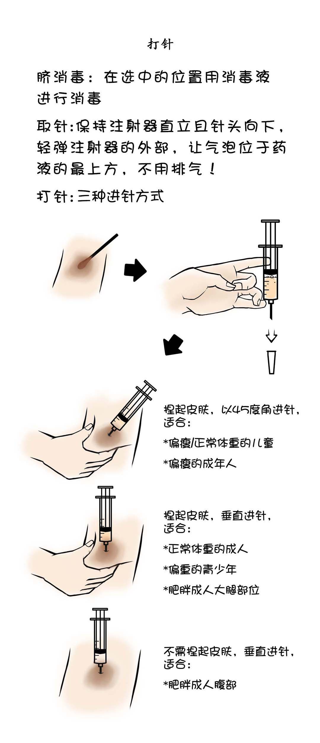 阿木说第一期肝素的注射教程