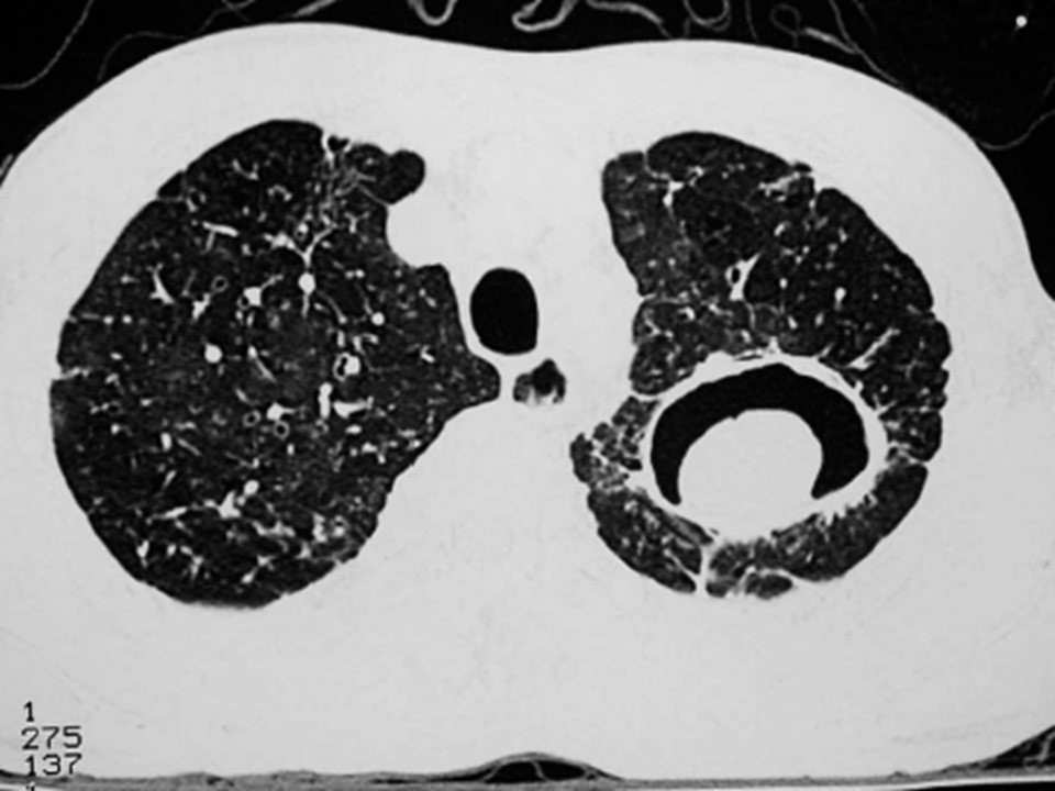 谢冬医生文章_上海市肺科医院-微医