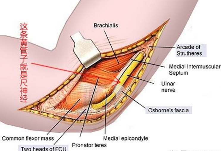 神经病变轴管综合症手麻和活动障碍是怎么了