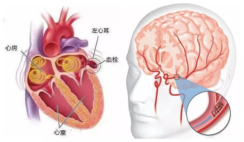 vHU181179500