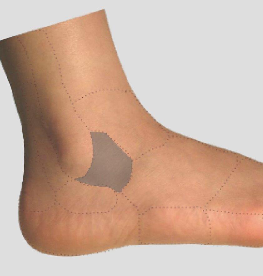 足踝教育篇-疼痛居家自查(三)足外侧面