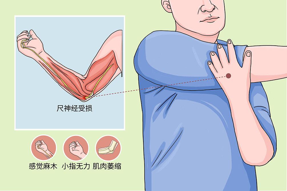 肘关节疼痛难忍怎么办肘管综合征该怎么治疗
