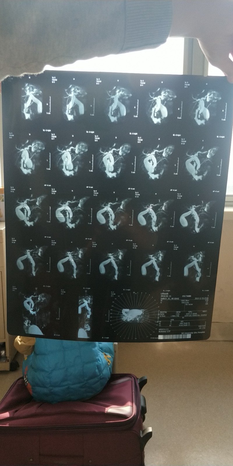 ct和磁共振的图像这样拍照才合格