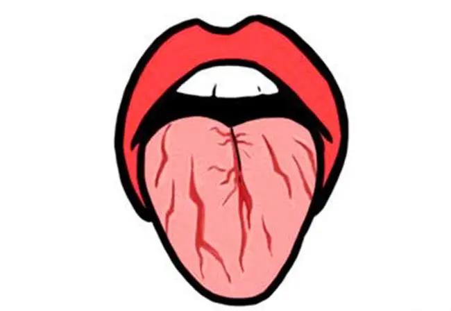 北京崇文门中医医院口腔黏膜专家陈友琼舌头有裂纹怎么办中医如何治疗