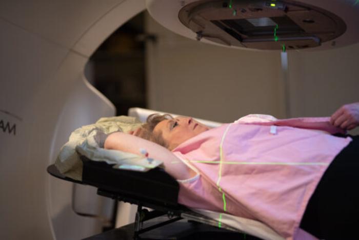乳腺癌放疗过程图片