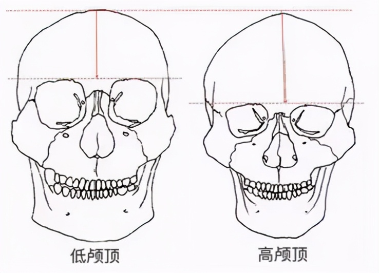 颅顶高度是指从发际线部位到头顶的距离.