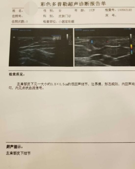 毛母质瘤1例_纪秀军医生文章_济南市人民医院-微医