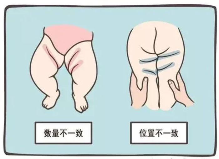 五十多岁了还得"先天病"——"先髋"到底是什么?