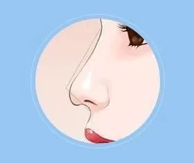 箭头鼻与鹰钩鼻有哪些区别