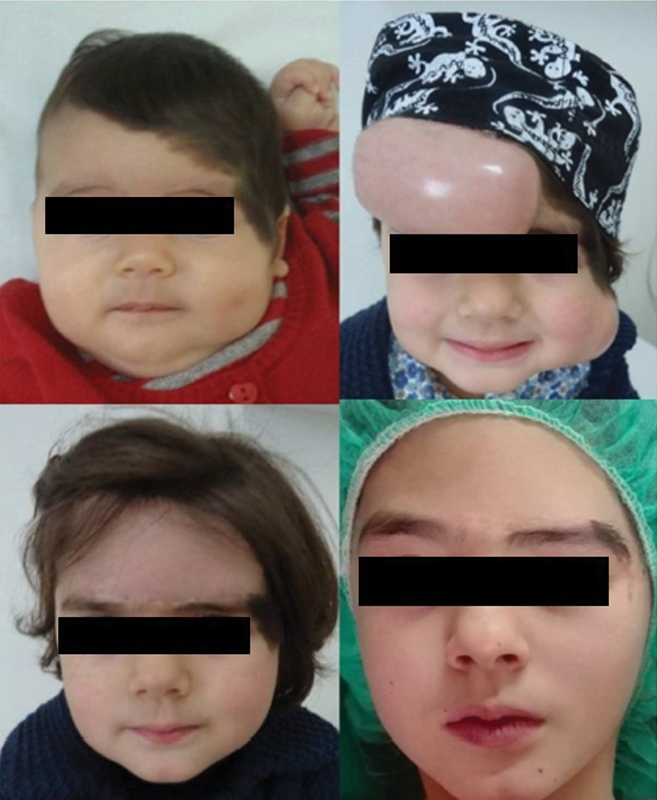 扩张器系列五:皮肤软组织扩张器适用范围_昝涛医生文章_上海交通大学