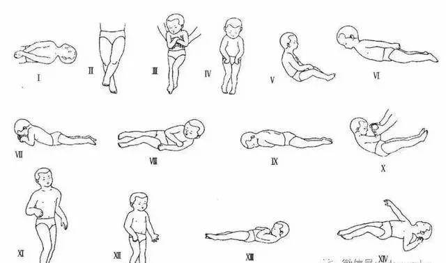 痉挛性截瘫原来是这样的