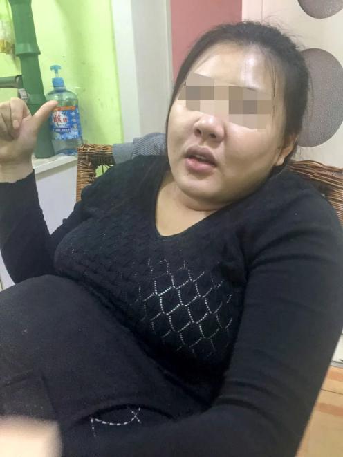 更年期肥胖女性减重手术后178斤体重大妈变女神