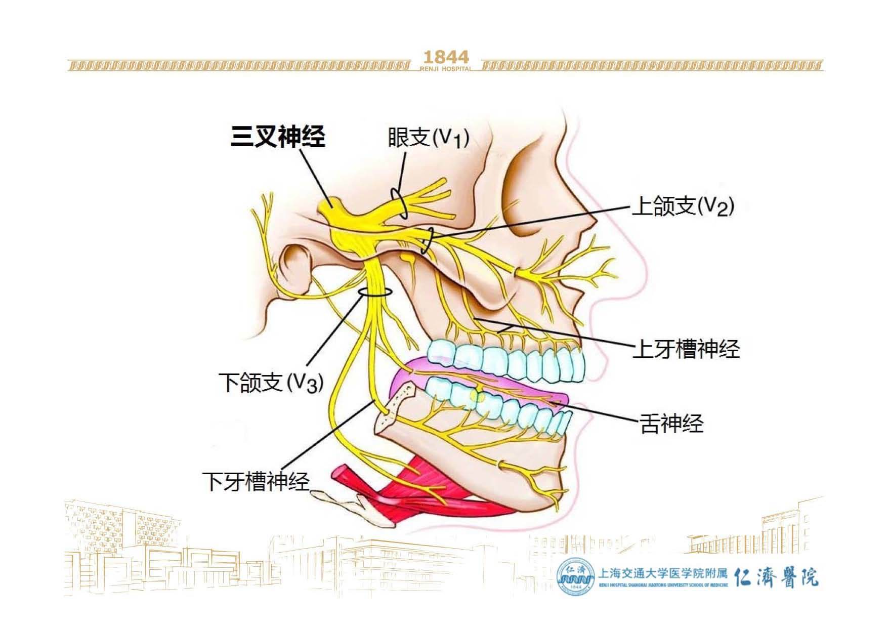 三叉神经与慢性头痛