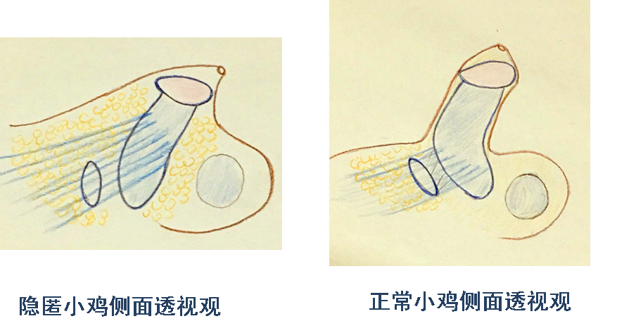 你家的"小鸡"还好吗?