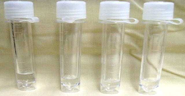 涨姿势了原来脑脊液就是脑子里的水 - 微医(挂号网)